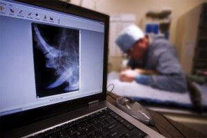 OSTEOARTRÓZA